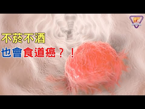 臺大醫師告訴你 不菸不酒也會食道癌？！｜好心肝·好健康