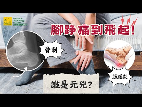 骨刺「刺」傷我的後跟嗎？淺談骨刺、筋膜炎和後跟痛的關係 – Pedorthic Technology 足科矯形