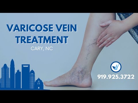 Varicose Vein Treatment Center in Cary, NC