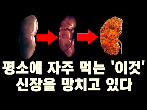 '이 음식들' 안 먹었더니 신장이 건강해졌다. 신장에 나쁜음식