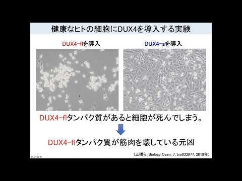 顔面肩甲上腕型筋ジストロフィーの治療法を開発する！