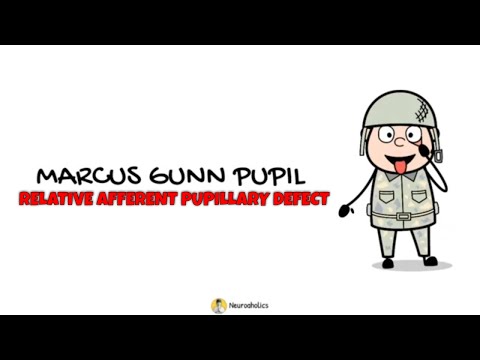 Marcus Gunn Pupil | RAPD | Neuroaholics