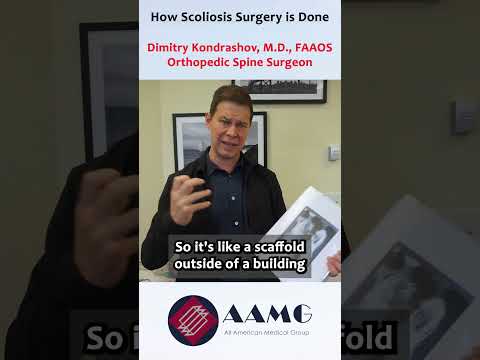 Dr. Kondrashov's Quick Explanation on the Complex #Scoliosis Surgery Process