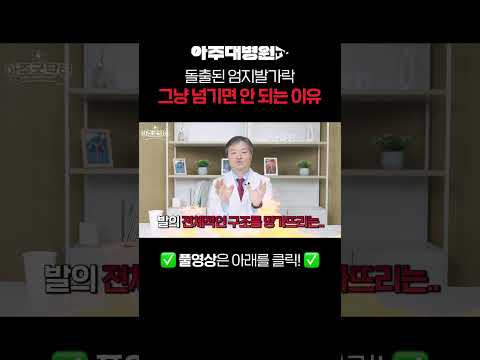 돌출된 엄지발가락 그냥 넘기면 안 되는 이유