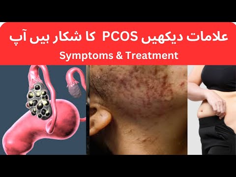 PCOS / PCOD Symptoms treatment In Urdu | Hindi