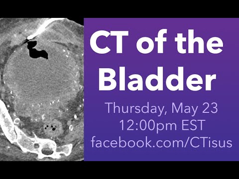 Facebook Live: CT of the Bladder