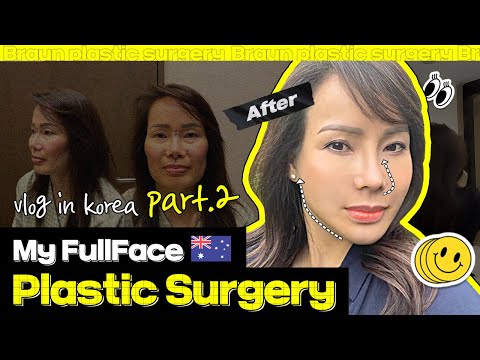 Complete Korean Plastic surgery Makeover│Middle aged woman finds her newself (Part2)