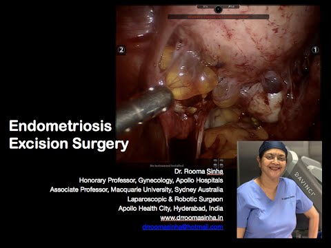 Endometriosis Excision Surgery Dr Rooma Sinha Apollo Hospitals Hyderabad