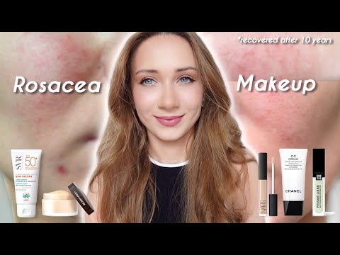 ROSACEA MAKEUP TO PREVENT FLARE-UPS *From Someone Who Recovered After 10 Years*