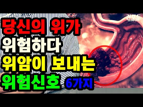 위암 걸리면 반드시 나타나는 위암 초기증상 6가지. 당신의 위가 위험하다