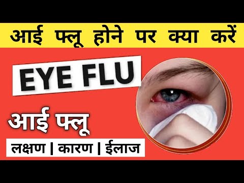 Eye flu hone par kya karen | Eye Flu | Conjunctivitis | Treatment