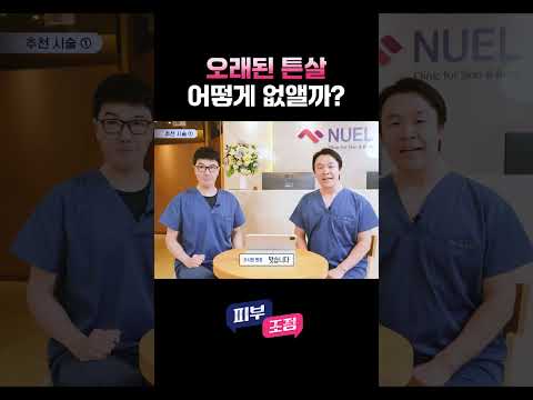 하얀 튼살, 없애는 방법은? #튼살 #피부고민 #피부과