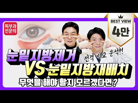 레이저 눈밑지방제거 vs 눈밑지방재배치 전격 비교 분석! I 무엇을 해야 할지 모르겠다면?