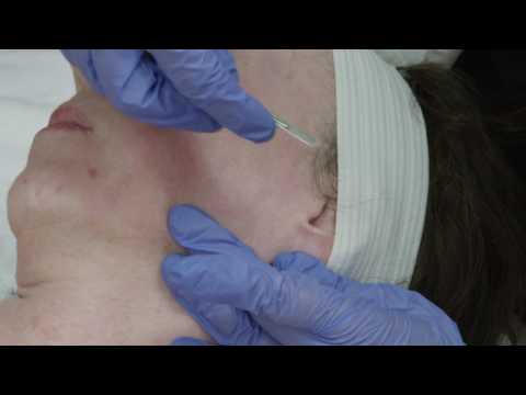 What is Dermaplaning? - Reno Sparks MedSpa - Dr. Calvin Van Reken