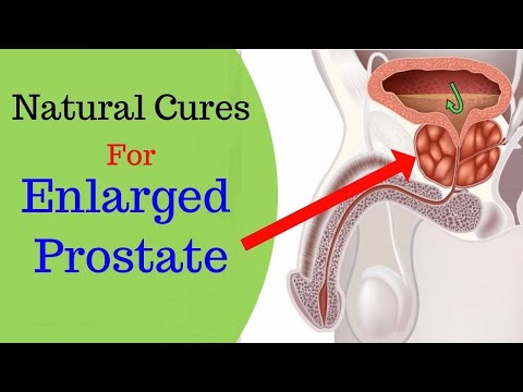 How to Treat An Enlarged Prostate | 5 Natural Remedies for an Enlarged Prostate.