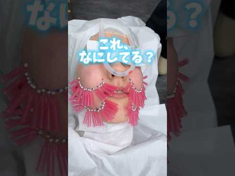 【うるおいコラーゲンリフト】スタッフ人気も高い🤭大人気美容針治療🪡お肌のたるみや口横のポニョがにになる方におすすめの最新治療です🫣㊙️ #shorts #うるおいコラーゲンリフト #うるコラ