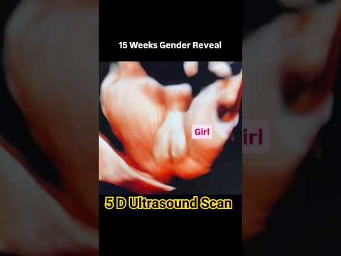 5d gender Reveal ultrasound scan #babyultrasound #pregnancyscan #baby