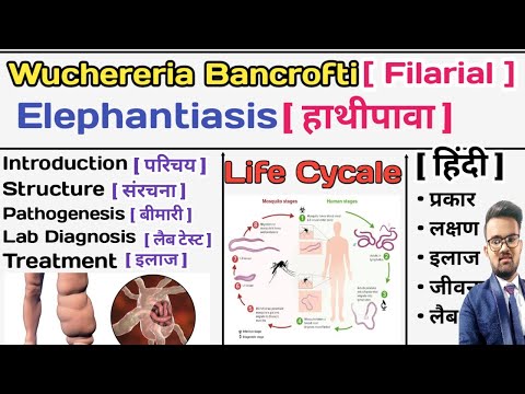 Wuchereria Bancrofti | Filarial Worm | Elephantiasis | हाथीपावा | Parasitology Notes | Microbiology