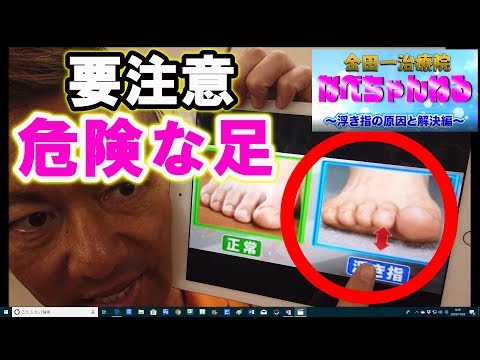 足の浮き指を自分で治すアイテム紹介