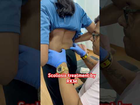 #rkm #chiropractor #worldfamouschiropractor #scoliosis ##drrajneeshkant