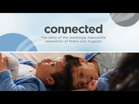 connected : the story of the seemingly impossible separation of conjoined twins Pedro and Augusto