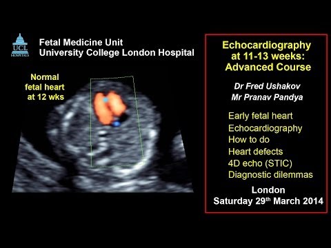 Fetal echocardiography at 11-13 weeks: ISUOG 2014 advanced course