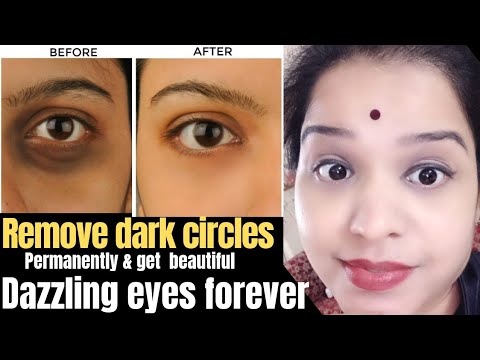 10 दिनों मे आंखो के काले घेरे हटाएं naturally। How to remove dark circles permanently, home remedy