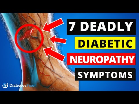 Top 7 Diabetic Neuropathy Symptoms You Shouldn't Ignore