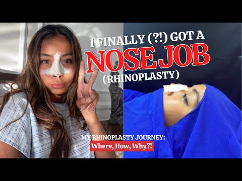 THE NOSE JOB I NEVER EXPECTED (My Rhinoplasty Journey)