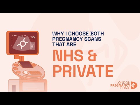 Why I choose both NHS and Private Scans | London Pregnancy Clinic