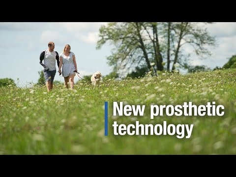 Latest advance in prosthetics is helping some patients regain movement and independence