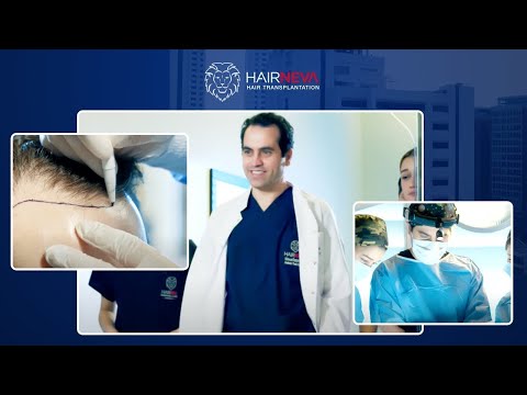 Hair Transplant Journey of Dr. Guncel Ozturk, founder of Hairneva - Part 1