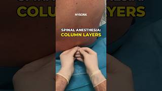 Spinal Anesthesia: Layers #spinal #anesthesia #layers