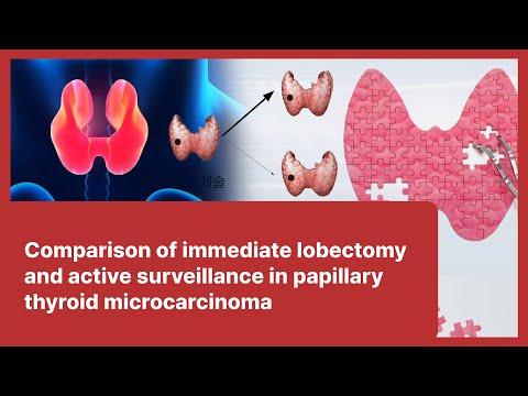 15 Comparison of immediate lobectomy and active surveillance in papillary thyroid microcarcinoma