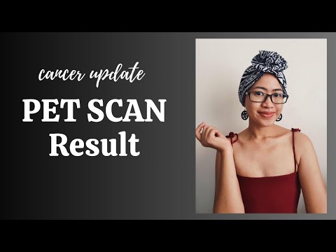 BREAST CANCER UPDATE - PET SCAN AND METASTASIS UPDATE