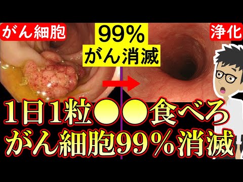 【科学的根拠あり】がんを抑制する超意外な食べ物！大腸がん肺がん乳がん胃がんの確率低下【悪性新生物｜胃癌｜原因｜膵臓がん】