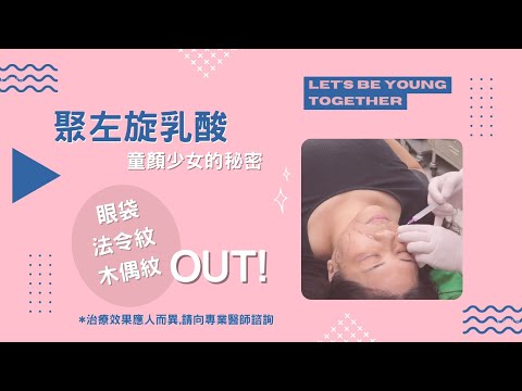 聚左旋乳酸_童顏少女的秘密-極緻美型·文心極緻皮膚科診所整形手術-林子鈞醫師：舒顏萃_Sculptra_聚左旋乳酸_童妍針_膠原蛋白增生劑