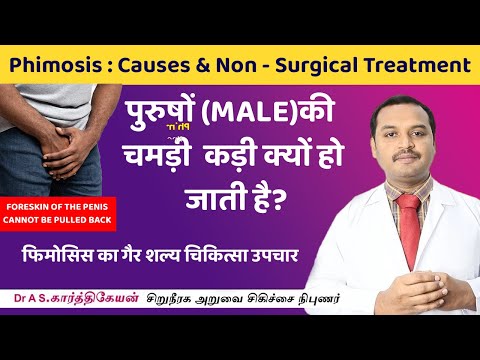 Phimosis Causes & Treatment-फिमोसिस का चिकित्सा उपचार-पुरुषों (Male)की चमड़ी  कड़ी क्यों हो जाती है?