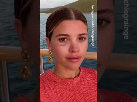 Video: Sofia Richie shows off the black eye she got from wakeboarding