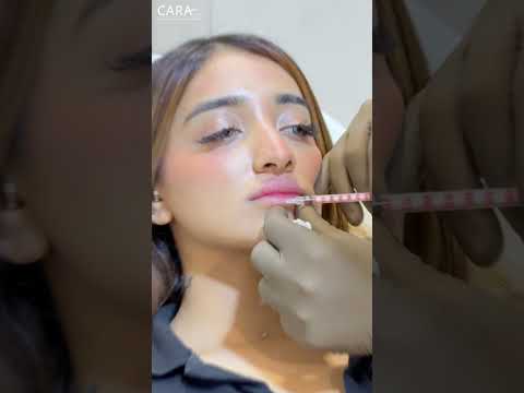 Lip Filler ASMR: The Art of Relaxation and Enhancement