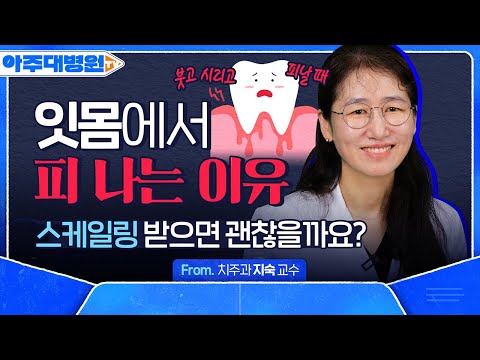 “치실은 효과가 별로 없습니다.” 치주질환 예방하려면 ‘이것’을 쓰세요! 🚨잇몸에서 피나는 사람 필수 시청🚨 치주과 지숙 [아주대병원TV]