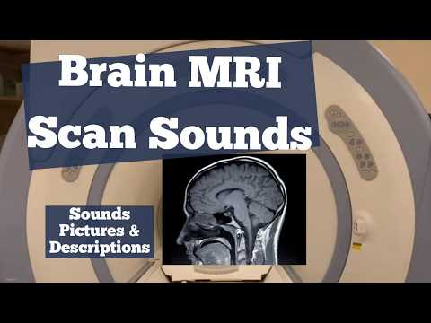 MRI Scan Sounds Explained - Exploring Brain MRI Scan Sounds and Protocols