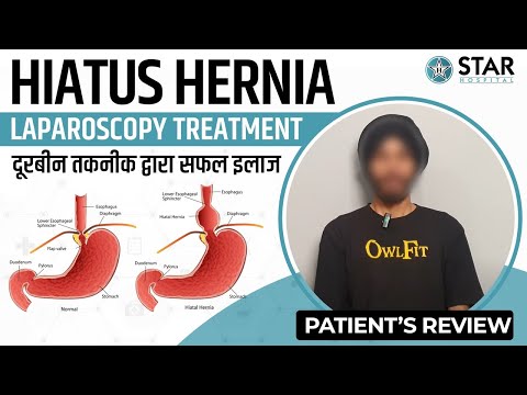 Best Hiatus Hernia Hospital In Jind | Best Hiatus Hernia Treatment In Jind | Best Doctor