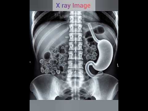 X ray Image🖼