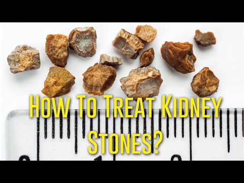 How To Treat Kidney Stones - Adam Oppenheim