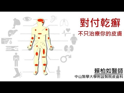 中山醫學大學附設醫院皮膚科 賴柏如醫師--"乾癬藥不藥？" 衛教影片