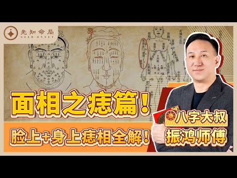 振鸿师傅：你身上和脸上哪些痣是吉哪些是凶？哪里的痣万万不可去除！