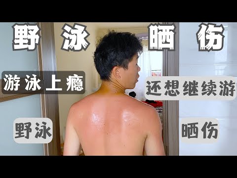 游泳被晒伤，还死性不改要继续游泳｜游泳｜野泳｜晒伤｜游泳上瘾｜帮哥带侄女｜vlog