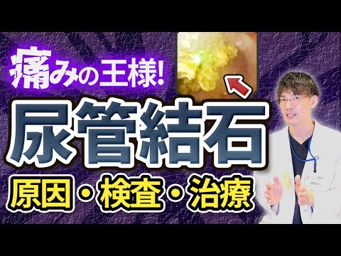 尿管結石、尿路結石の原因・検査・治療について泌尿器科専門医が詳しく解説