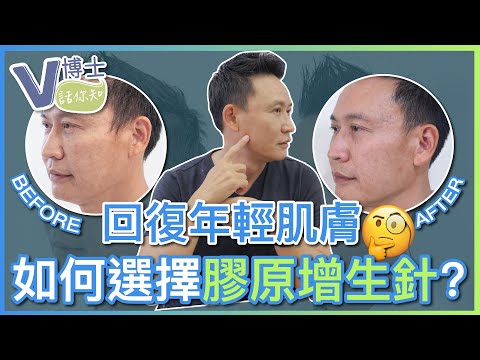 回復年輕肌膚！如何選擇膠原增生針？【V博士話你知】